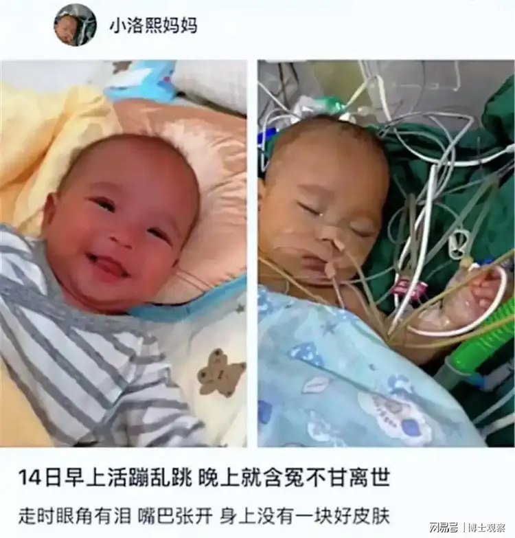 小洛熙手术前后对比：早上活蹦乱跳，晚上含冤离世