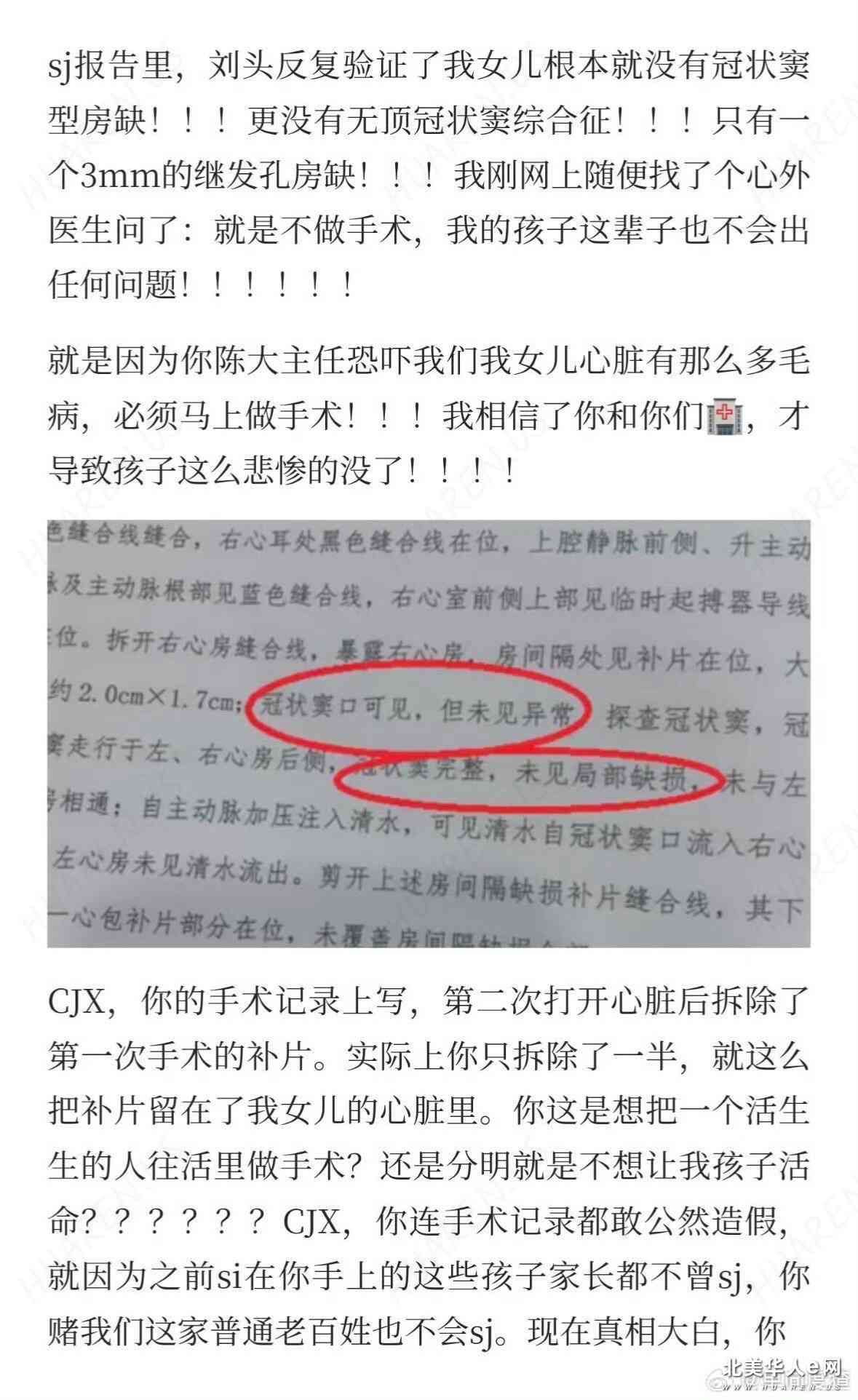 邓蓉蓉的控诉原文截图（一）：刘头反复验证，根本没有冠状窦型房缺