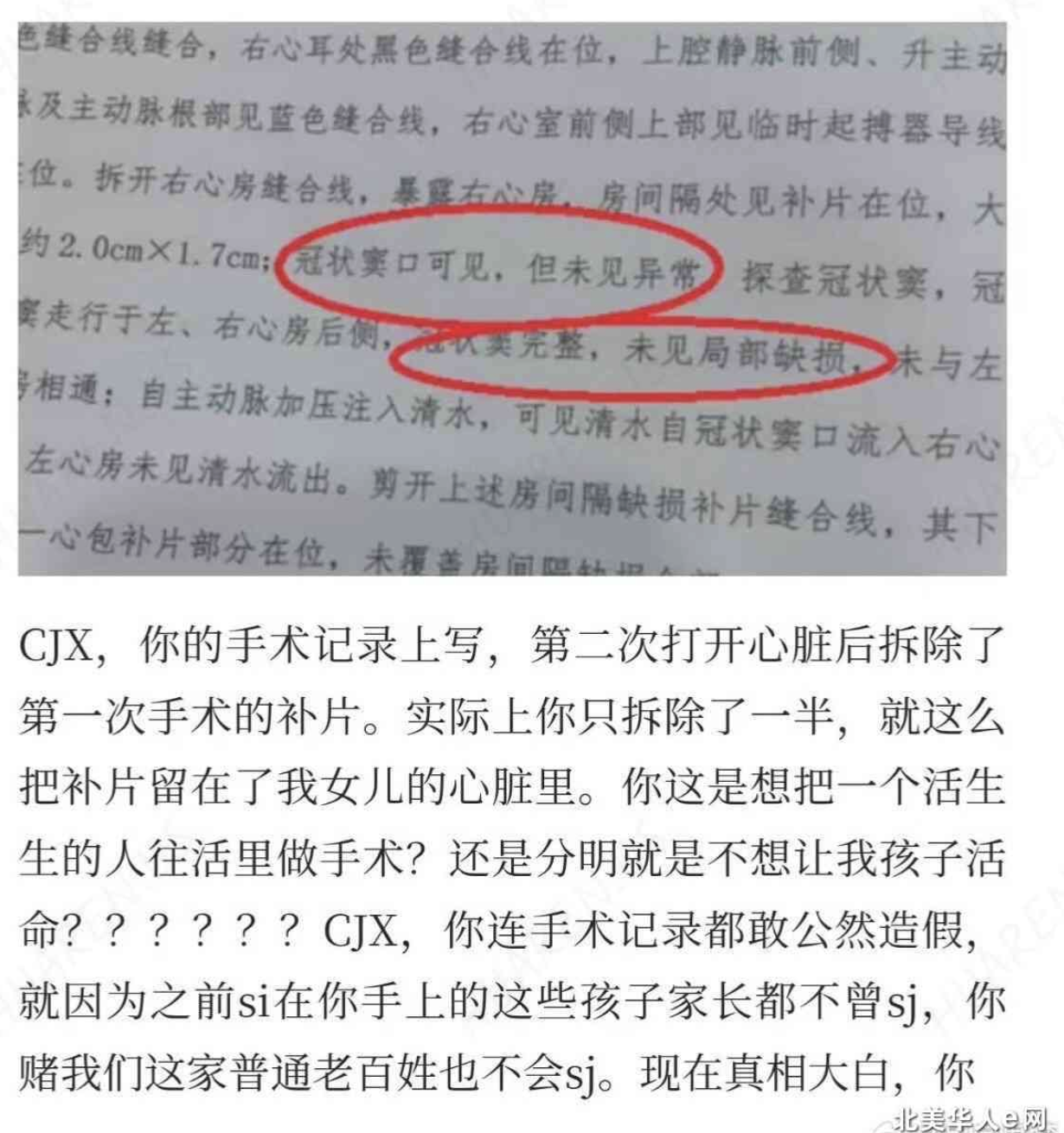 邓蓉蓉的控诉原文截图（二）：CJX你这是想把一个活生生的人往活里做手术？