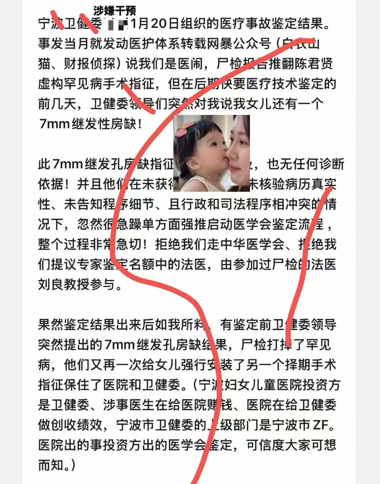 家属长文截图上半屏：标题涉嫌干预被马赛克盖住并在上方以小字标注，正文讲事发当月公众号网暴说家属是医闹、鉴定前几天卫健委领导突然提出7mm继发孔房缺、拒绝中华医学会与刘良教授参与、以及医院投资方是卫健委的利益链