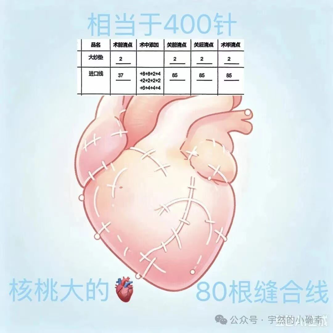 一张配图：中间是手术护理清点单的截图，表头为品名、术前清点、术中添加、关前清点、关后清点、术毕清点；大纱垫一行四次清点均为2；进口线一行术前清点37、术中添加写着加8加8加2加4、加2加2加2加2、加6加4加4加4，关前清点85、关后清点85、术毕清点85。图上另有一颗画满缝合针脚的心脏插画，配文写着核桃大的心脏、80根缝合线、相当于400针